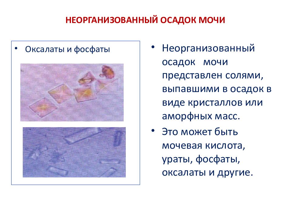 Кристаллы оксалаты в моче большое. Аморфные фосфаты микроскопия мочи. Соли в моче. Соли в моче классификация. Фосфаты в кислой моче.