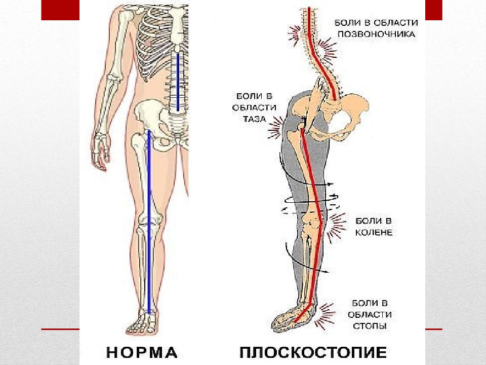 Карта болей в спине