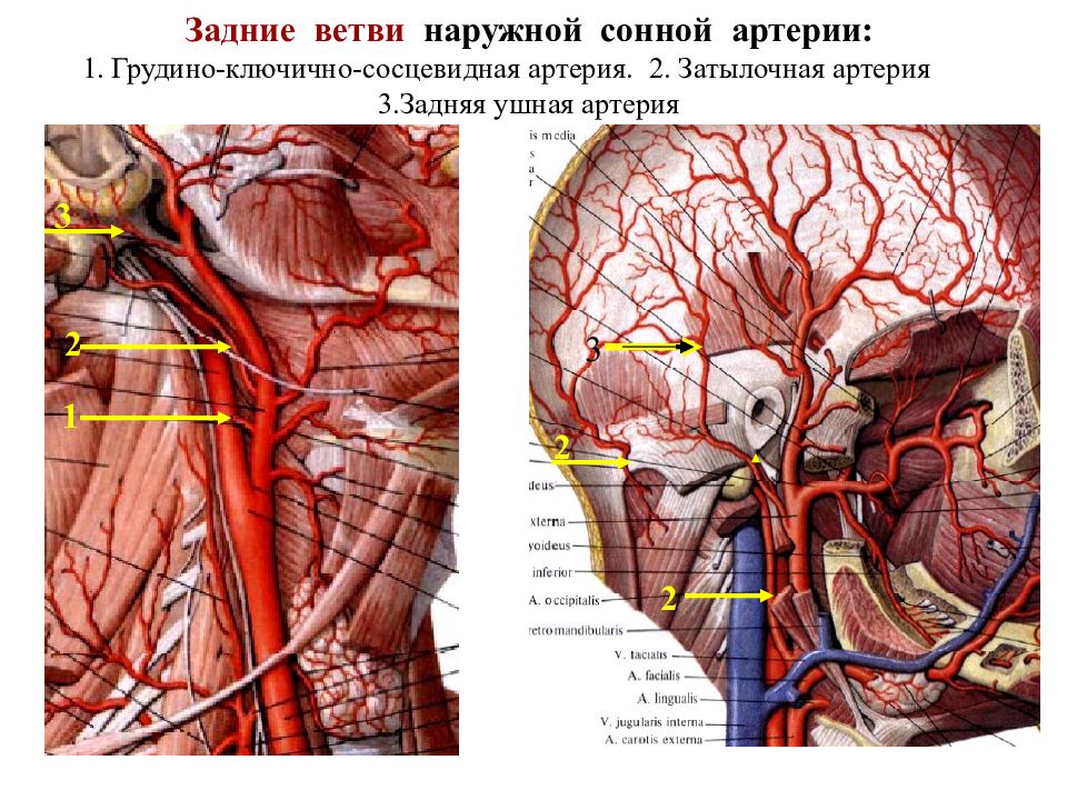 Правая внутренняя сонная артерия где находится