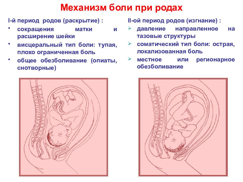 Точки обезболивания при родах в картинках