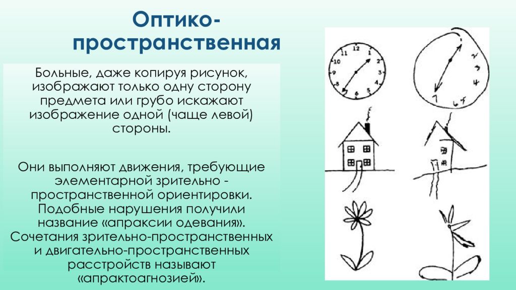 Какие есть признаки рисунка. Оптико-пространственная агнозия. Односторонняя оптико-пространственная агнозия. Оптико пространственные нарушения. Зрительная пространственная агнозия.