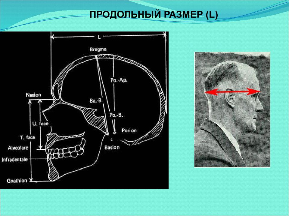 Развитие черепа. Продольный диаметр черепа. Продольная длина черепа. Продольный размер головы. Назион.