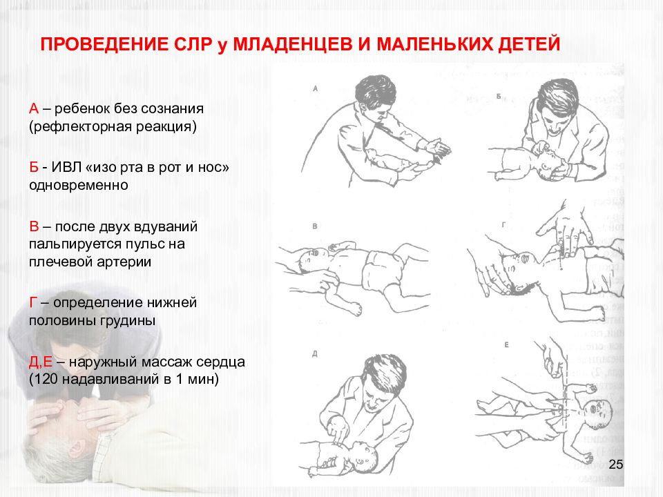 История и современность сердечно легочной реанимации презентация