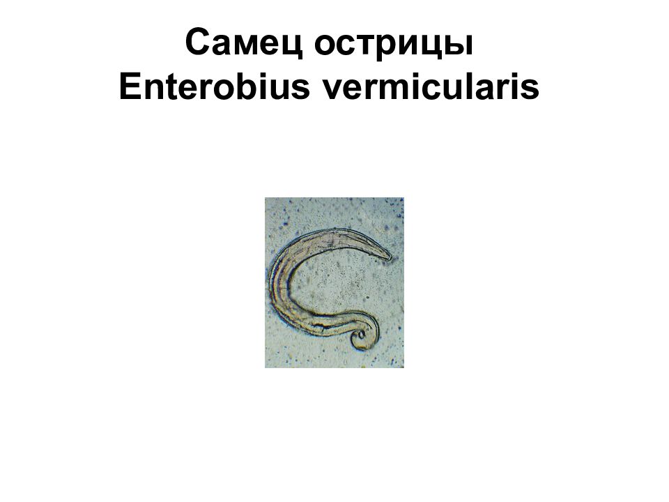 Острицы лечение. Острица детская (Enterobius vermicularis) размер. Гельминтология энтеробиоз.