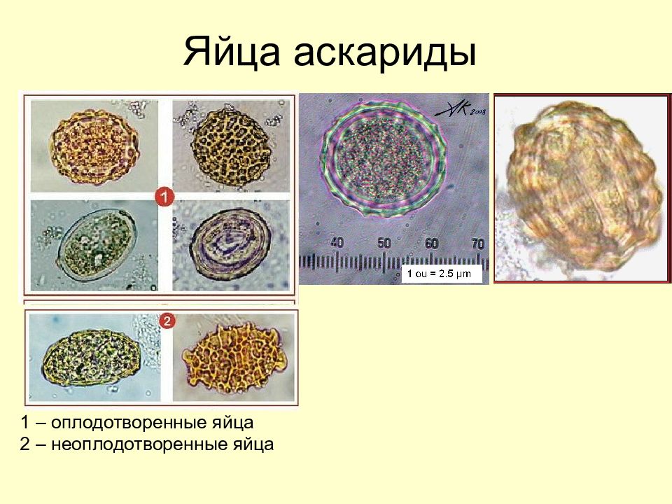 Яйцо аскариды рисунок