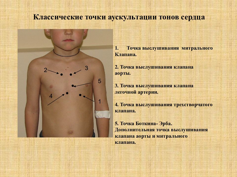 Точки аускультации сердца рисунок