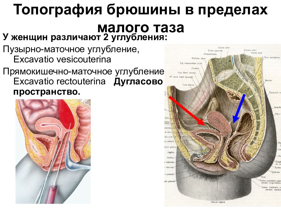 Дугласово пространство. Прямокишечно-маточное углубление анатомия. Прямокишечно-маточное (дугласово) пространство. Прямокишечно-маточное углубление [дугласово пространство]. Брюшина дугласова пространства.