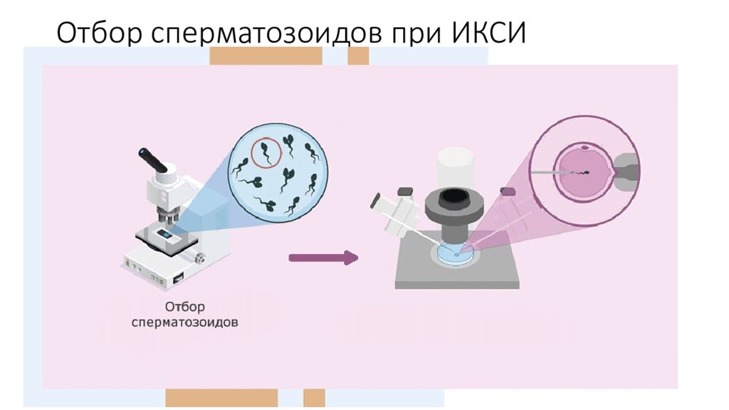 Вспомогательные репродуктивные технологии. ИКСИ. Институт комплексных стратегических исследований ИКСИ. Плюсы и минусы репродуктивных технологий.