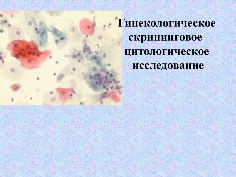 Гинекологическое скрининговое цитологическое исследование
