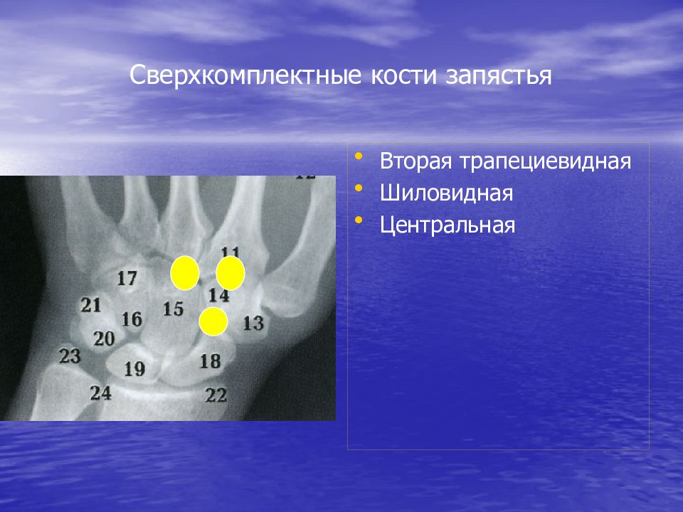 Лучезапястный сустав рентген анатомия картинки