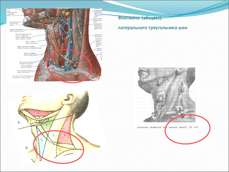 Топографическая анатомия и оперативная хирургия шеи презентация