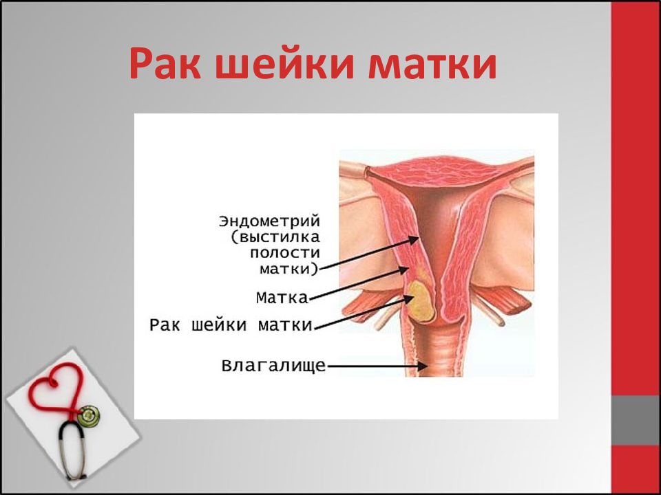 Онконастороженность презентация для врачей