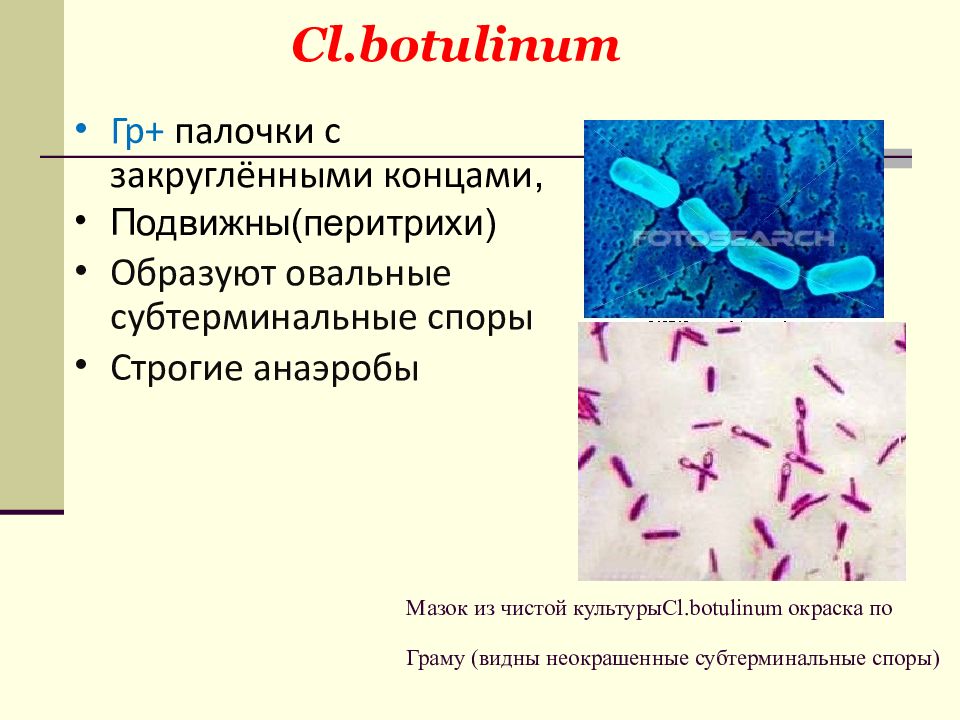 Кластридии. Клостридия ботулинум микробиология. Клостридии микробиология морфология. Клостридии шавоэ. Клостридии ботулизма микробиология.