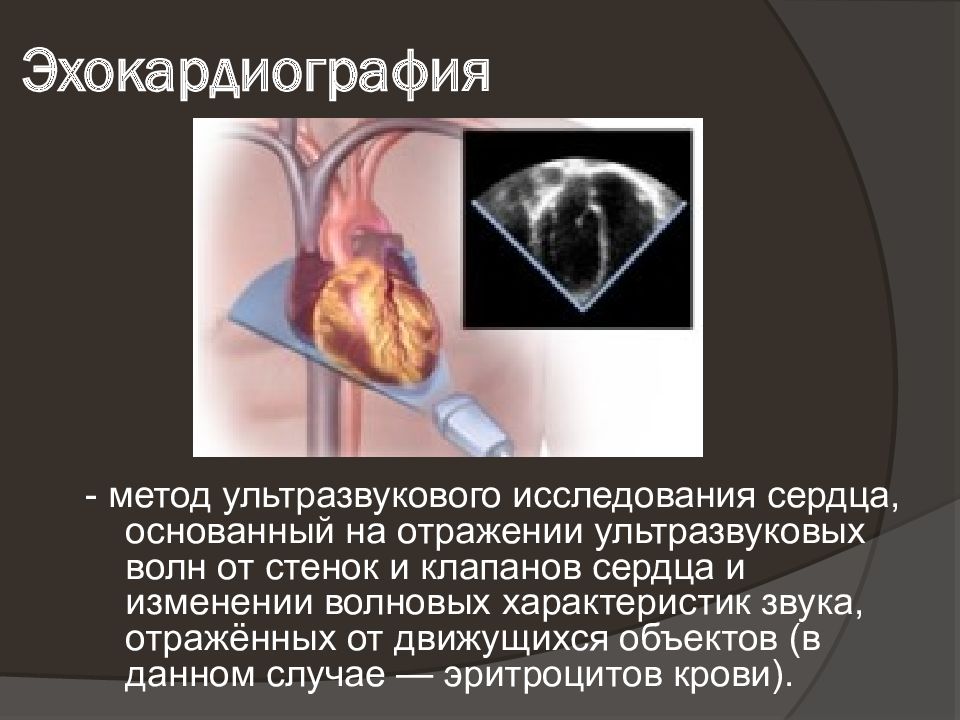 Эхокардиография (узи сердца / эхо кг). Ультразвуковые методы исследования сердца. Ультразвуковые методы исследования сердца. Эхо-узи (узи сердца). Эхокардиография эхо кг сердца что это.