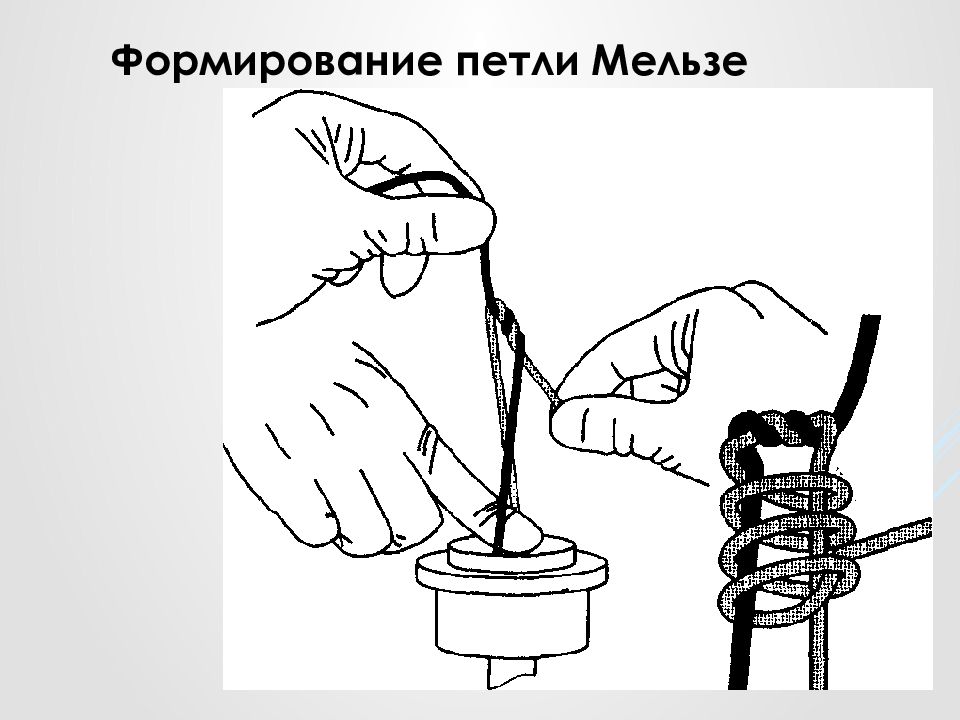 Формирование узлов. Петля Редера. Узел Мельзе. Интракорпоральный шов. Петля Редера для аппендэктомии.