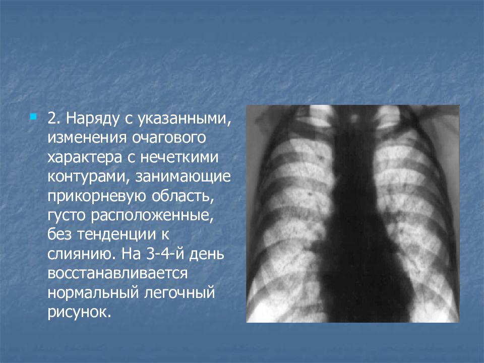 Наряду с указанным. Отравление угарным газом рентген легких. Изменения в легких при отравлении угарным газом. Нормальный легочный рисунок. Кт легких при отравлении угарным газом.