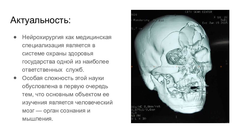 Презентация на тему нейрохирургия