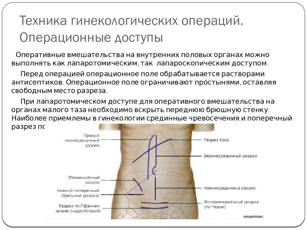 Малые гинекологические операции презентация