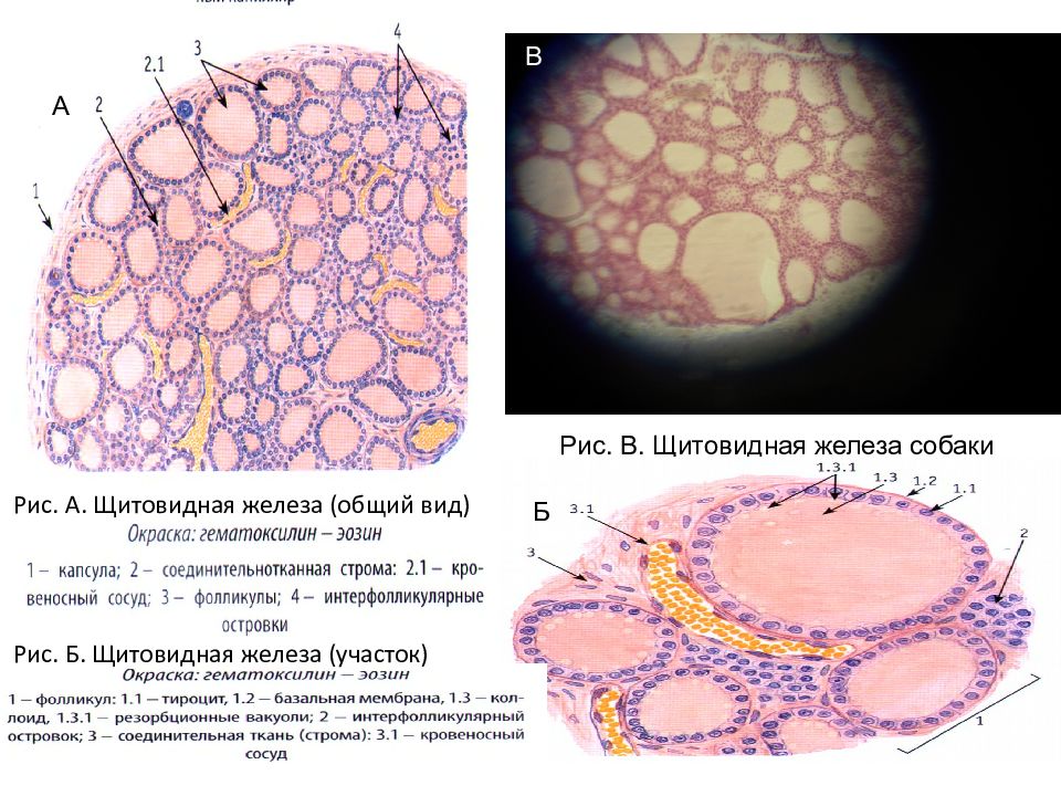 Ткани щитовидной железы. Эпителий щитовидной железы гистология. Железистый эпителий срез щитовидной железы. Эпителий щитовидной железы гистология препарат. Строма щитовидной железы гистология.