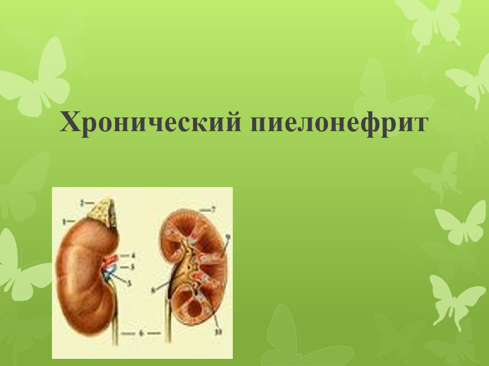 Хронический пиелонефрит