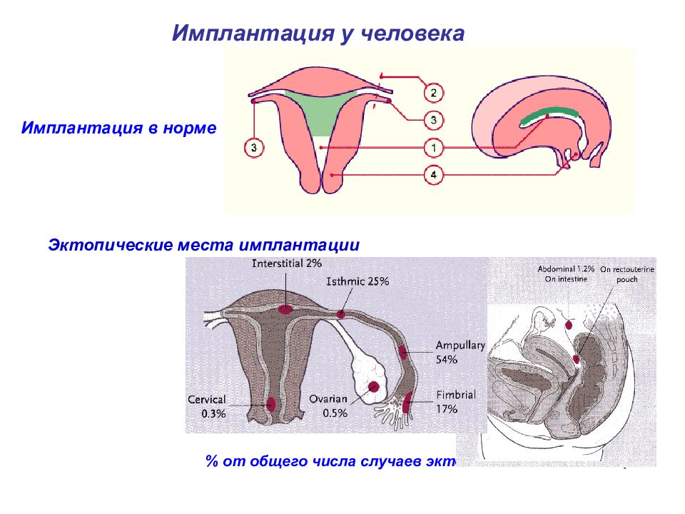 Имплантация в матку симптомы