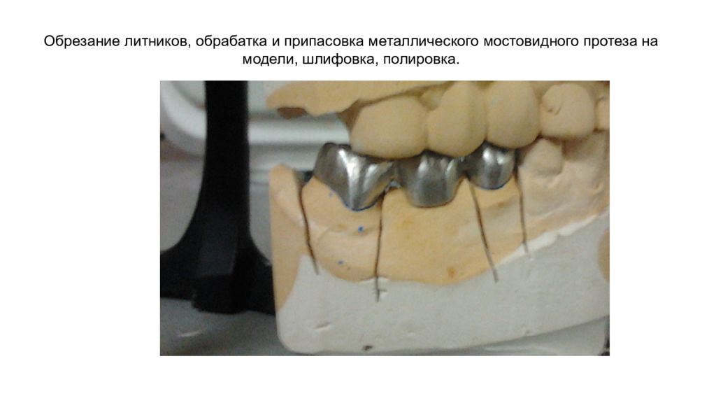 Противопоказания к изготовлению коронки