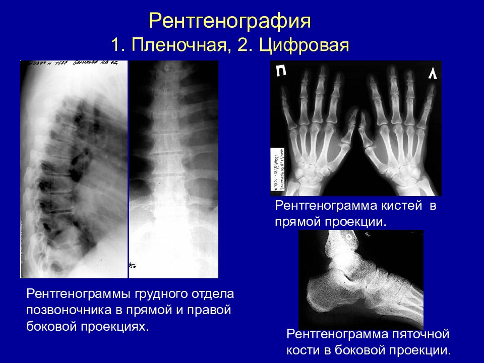 Рентгенография в 2 проекциях. Рентгенография легких 1 проекция/2 проекции. Рентген грудного отдела в прямой проекции. Рентген грудного отдела в 2 проекциях. Рентгенография костно-суставной системы.