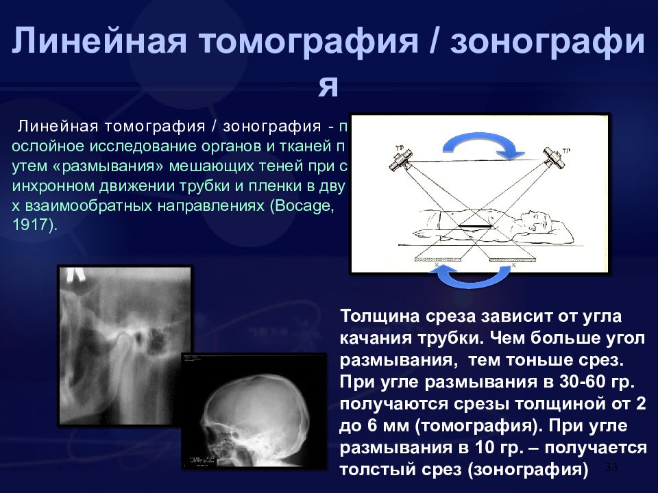 Вариант зонографии позволяющий получить развернутое плоскостное изображение челюстей