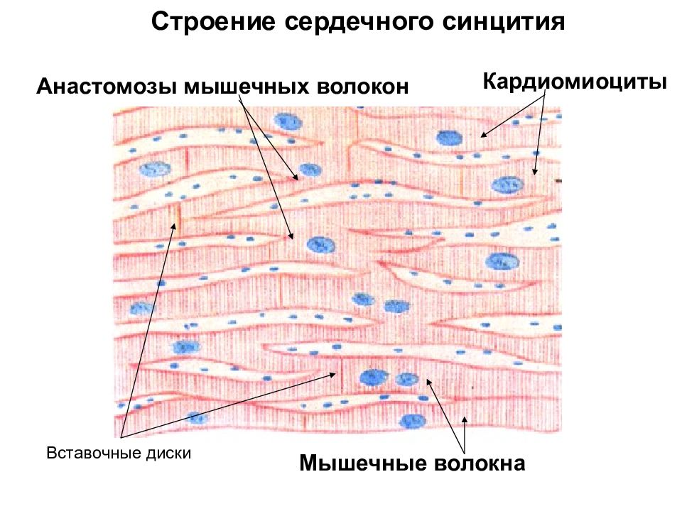 Атипичные кардиомиоциты рисунок