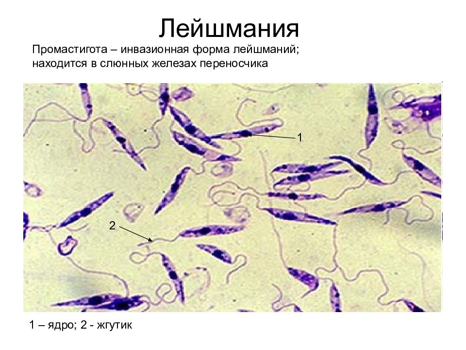 Лейшмании. Лейшмания препарат микроскоп. Leishmania Tropica строение.