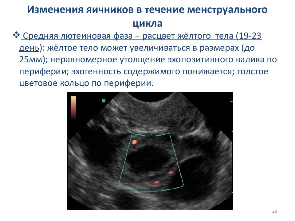Эндометрия 23. Жёлтое тело в яичнике на УЗИ 19мм. Желтое тело диаметром 22 мм в правом яичнике. Жёлтое тело яичник 19мм на УЗИ беременность. Жёлтое тело в яичнике на УЗИ 25 мм.