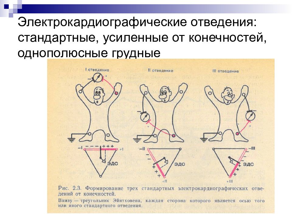 Дополнительные отведения экг презентация