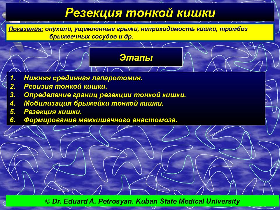 Презентация операции на прямой кишке