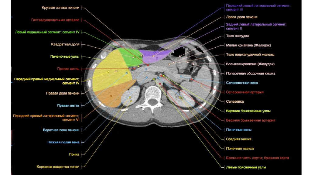 Сегменты печени на кт анатомия. Кт брюшной полости аксиальный срез. Кт органов брюшной полости аксиальный срез. Кт брюшной полости фронтальный срез. Мрт органов брюшной полости анатомия.