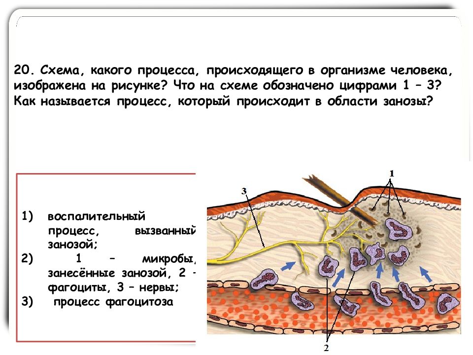 Воспалительный процесс