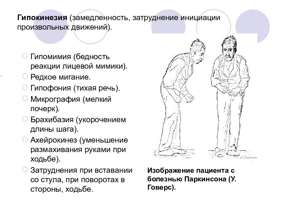 Низким уровнем психической активности замедленностью движений. Замедленность движений. Замедленность темпа и реакций человека. Проба на гипокинезию. Произвольные движения человека обеспечивают.