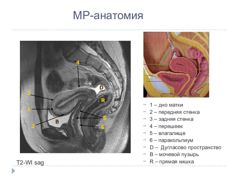 Дугласовое пространство. Прямокишечно-маточное (дугласово) пространство. Дугласово пространство малого таза. Дугласово пространство пальпация. Брюшина дугласова пространства.