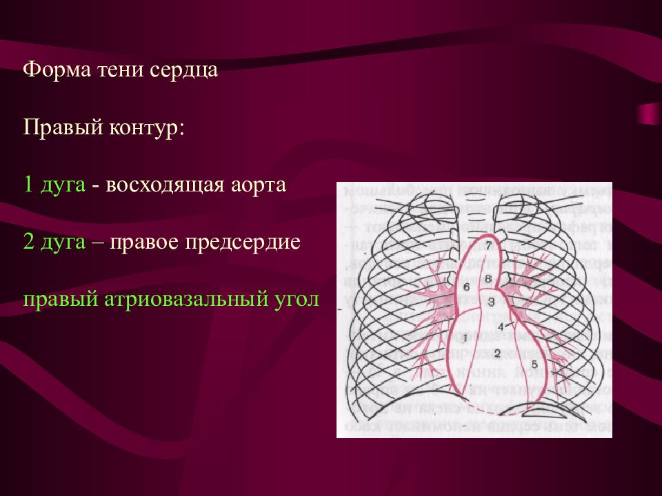 4 дуги сердца. Правый контур сердца. Аортальная форма тени сердца. Атриовазальный угол. Дуги контура сердца.