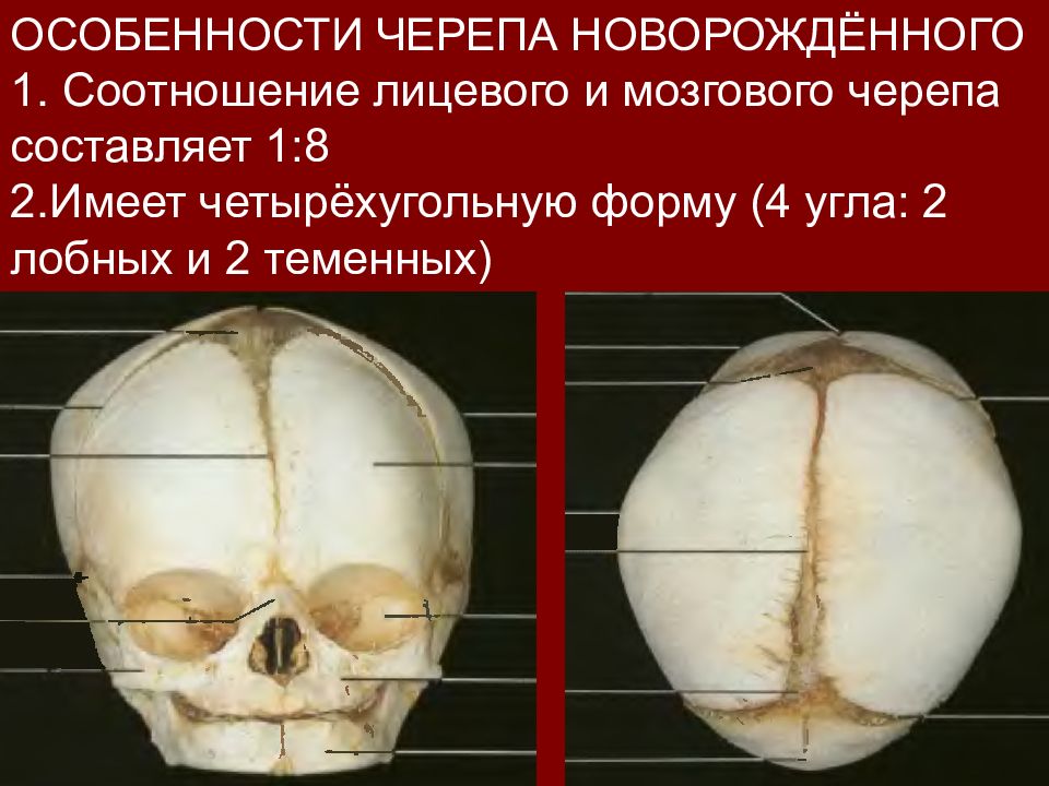 Мозговой череп новорожденного. Строение черепа новорожденного. Особенности лицевого черепа новорожденного. Анатомические структуры черепа новорожденного. Череп новорожденного анатомия.