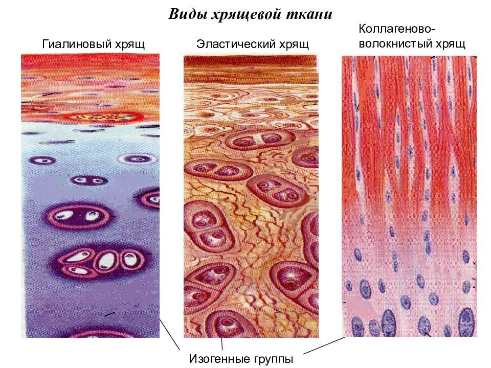 Волокнистый хрящ рисунок с подписями