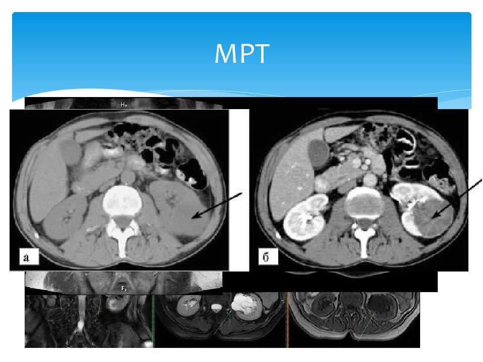 Точное исследование. Мрт визуализация мягких тканей. Мрт лучевая диагностика. МР томография лучевая диагностика. Аномалии почек лучевая диагностика.