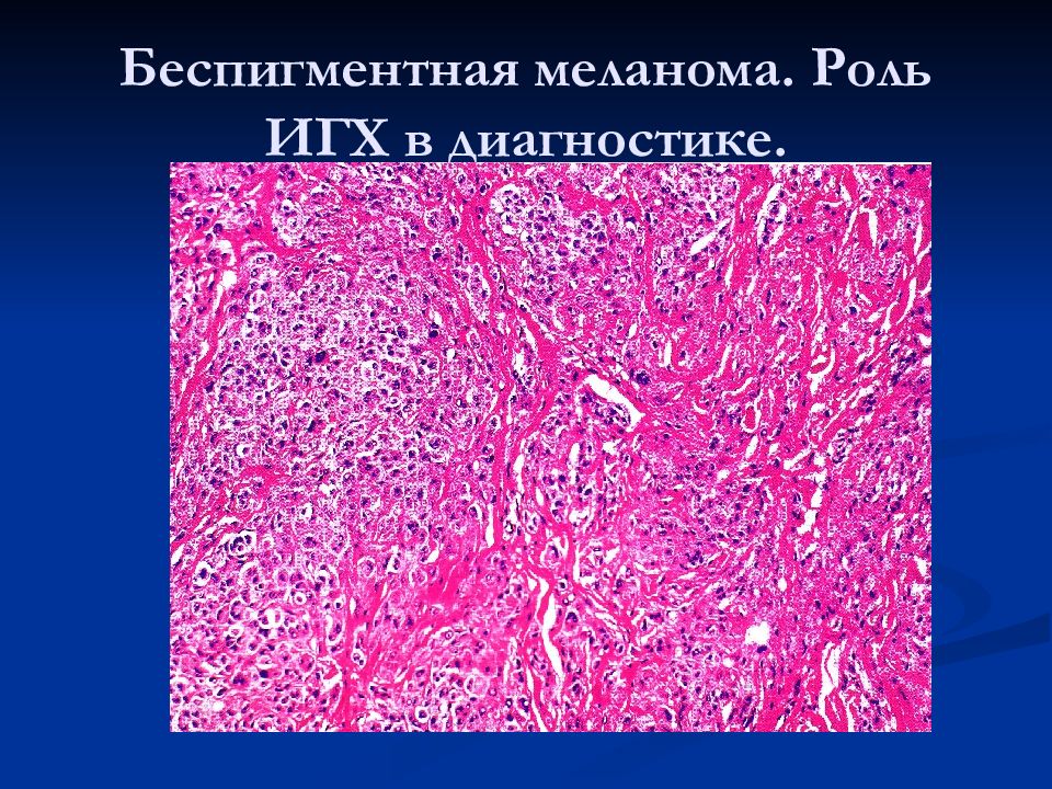 Мезенхимальные опухоли патологическая анатомия презентация