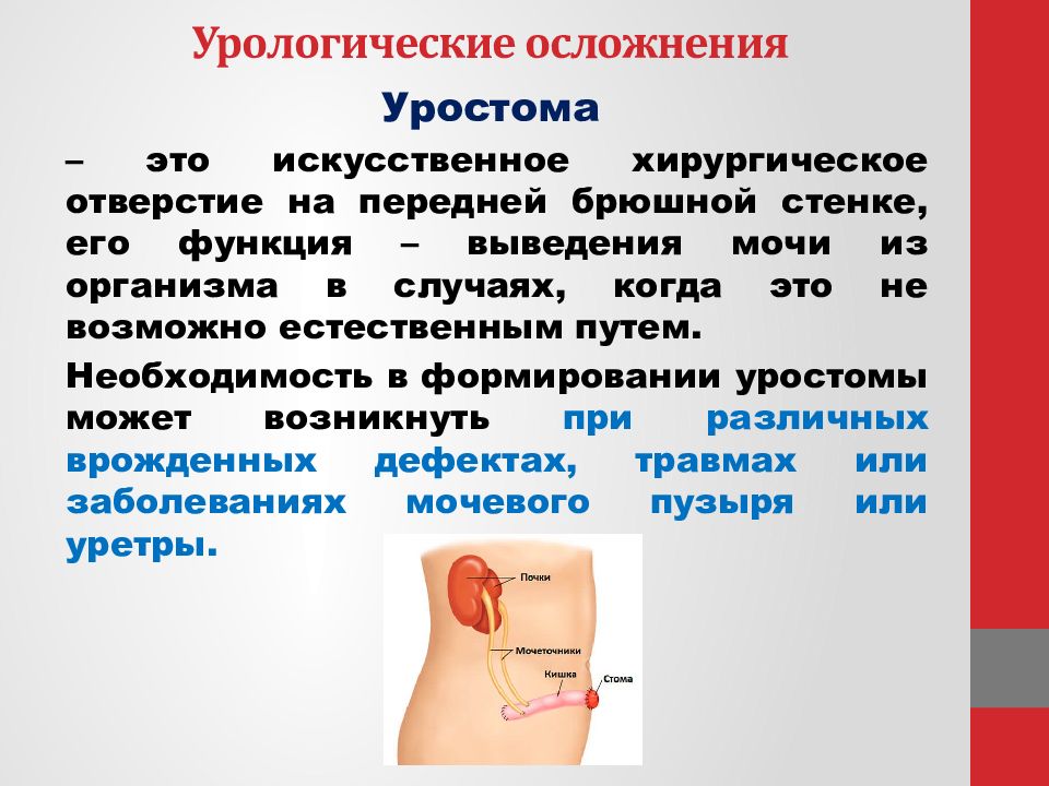 Уход за цистостомой презентация