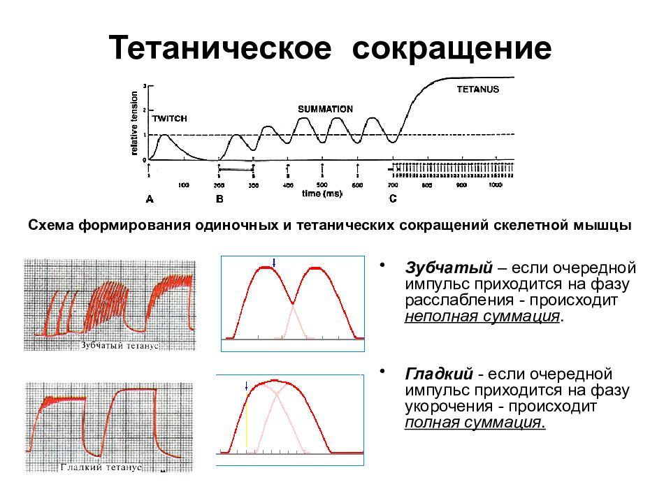 Режим одиночной. Тетанус физиология мышц. Гладкий тетанус это физиология. Суммация сокращений в фазу укорочения мышцы. Одиночные и тетанические сокращения физиология.