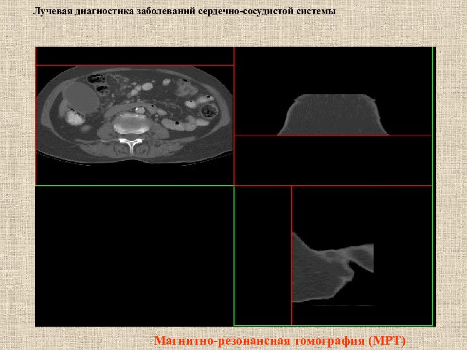 Лучевая диагностика нервной системы презентация