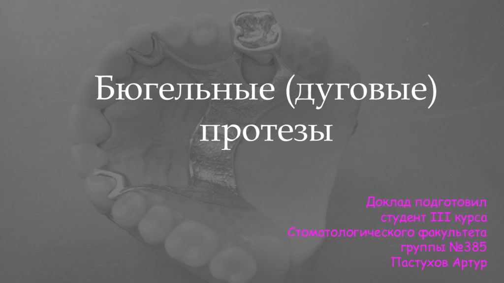 Бюгельные (дуговые) протезы Доклад подготовил студент III