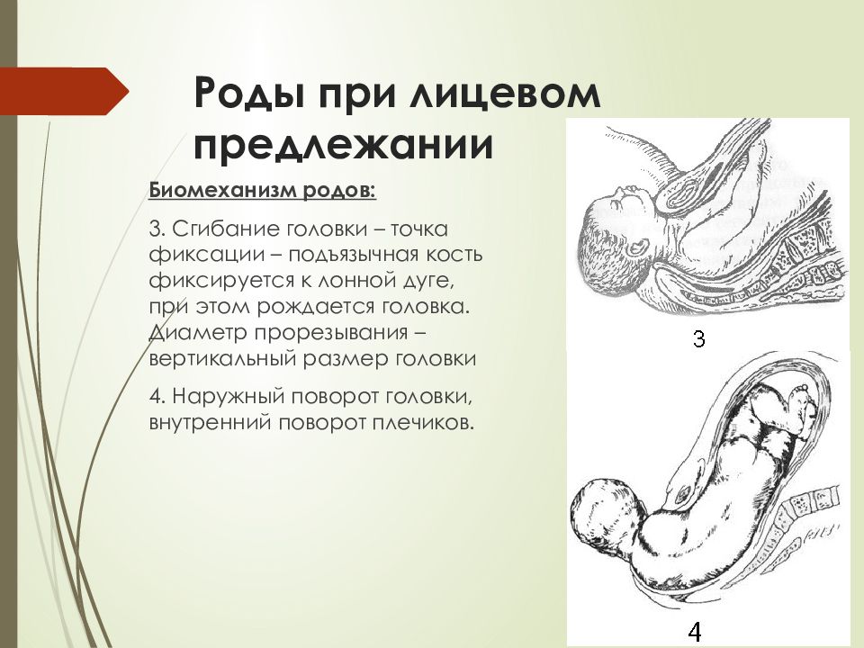 Разгибательные вставления головки презентация