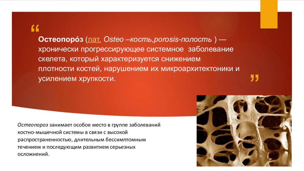 Остеопороз это. Остеопороз презентация. Клинические проявления остеопороза. Остеопороз симптомы. Профилактика остеопороза презентация.