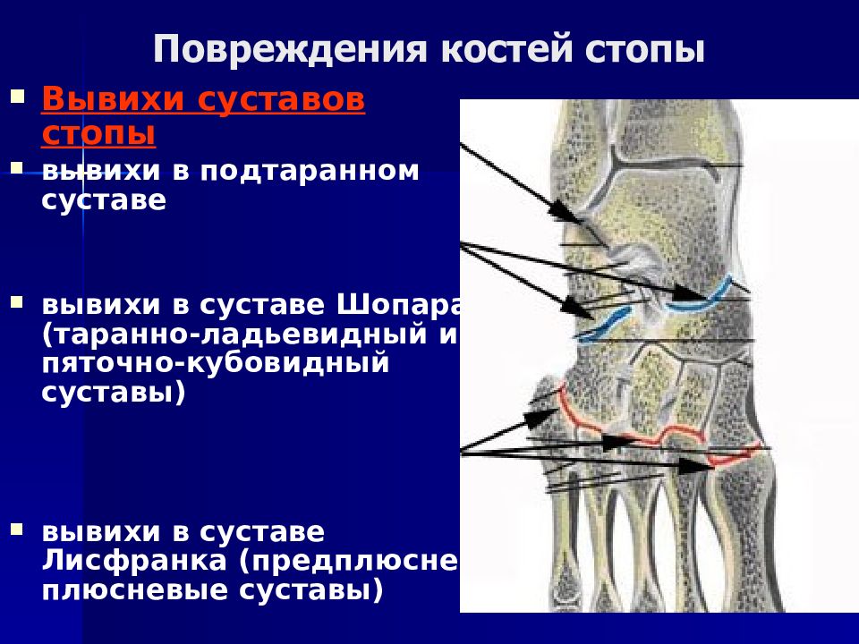 Топографическая анатомия голеностопного сустава презентация