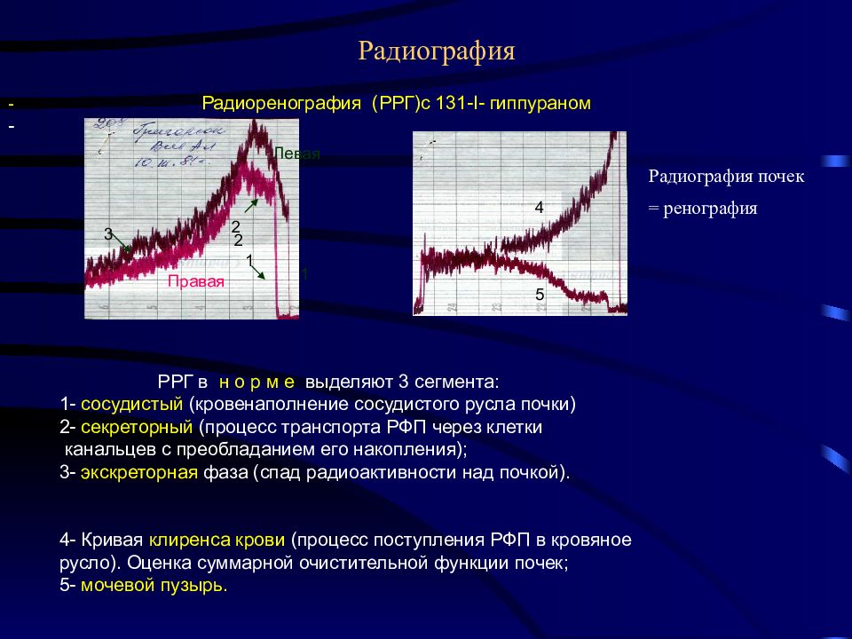 Радиография. Радиоизотопная ренография. Радиоизотопная урография это. Ренография почек. Радионуклидная ренография.